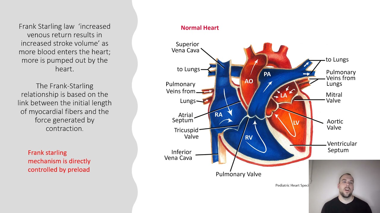 Right Ventricular Infarct 15 min lesson