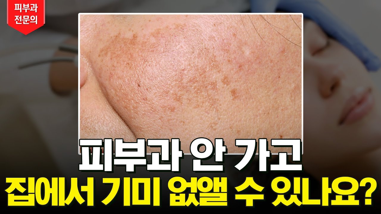 집에서 기미없애는법, 이건 꼭 알아두세요 ✅ | 기미 크림 앰플 실제 효과 🧴