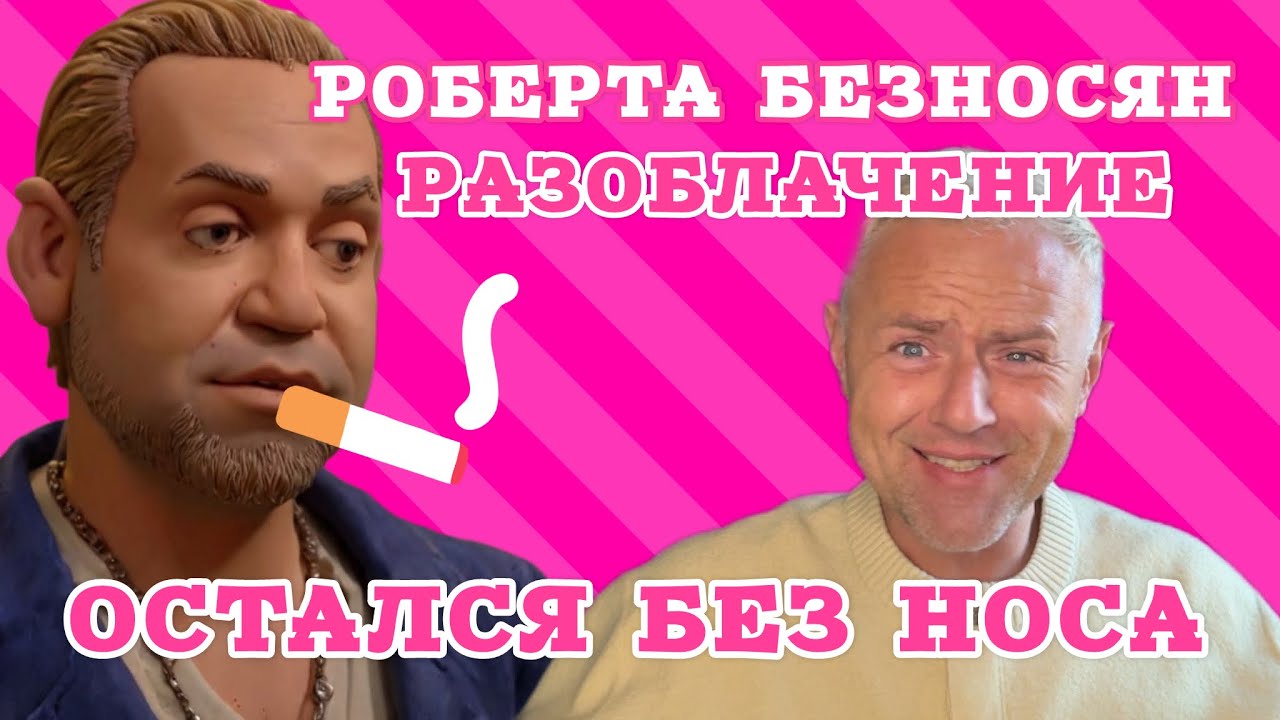 Шок! Операцию на нос Робертиньё делал у стоматолога. Прокурил нос после хирургии. 