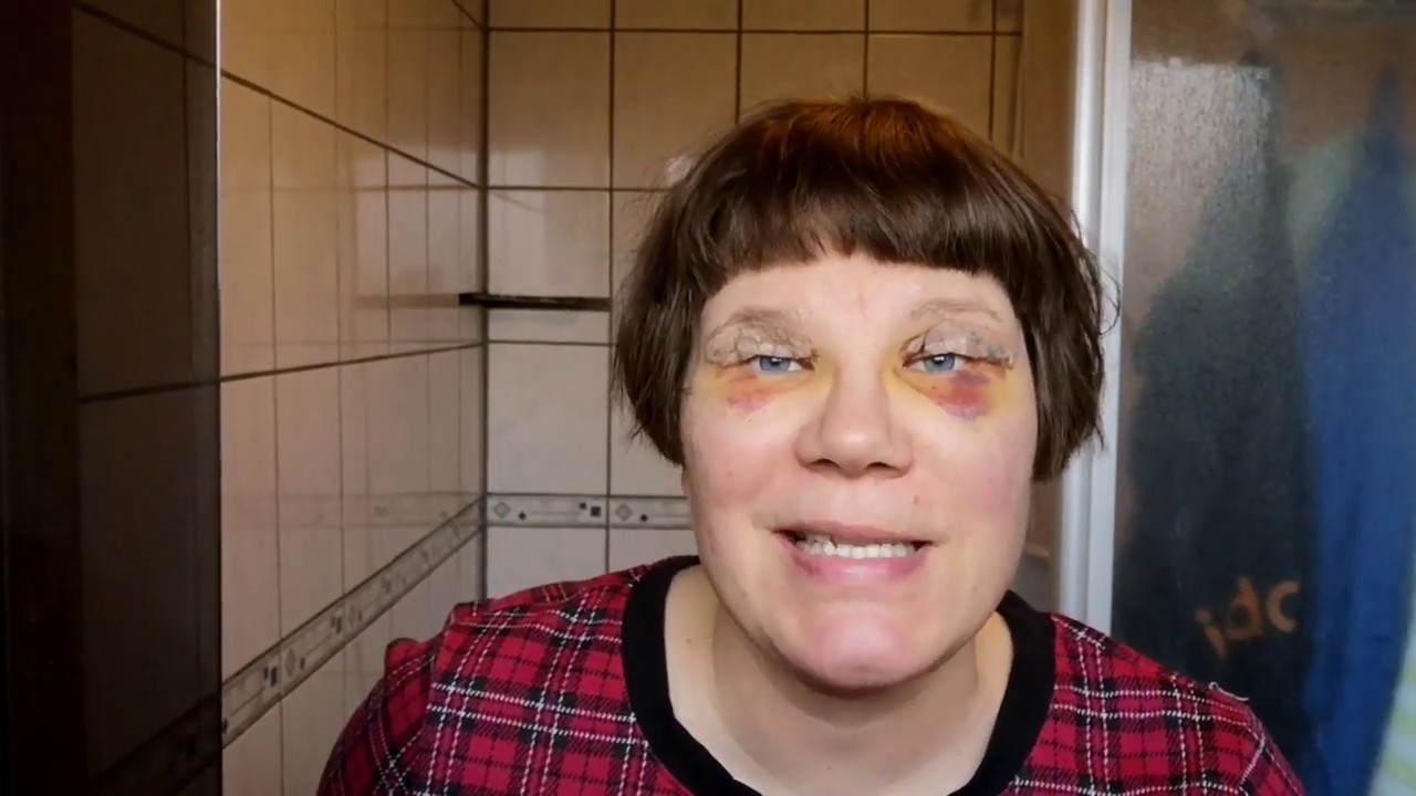 👩‍⚕️🔪💉 PLASTIIKKAKIRURGIAA 😲 2/2