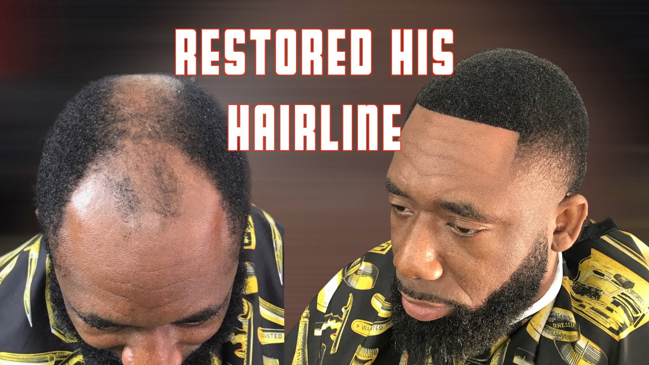 😲 JAW DROPPING HAIRLINE RESTORATION. RECEDING hairline service. #haircut #hairlinerestoration