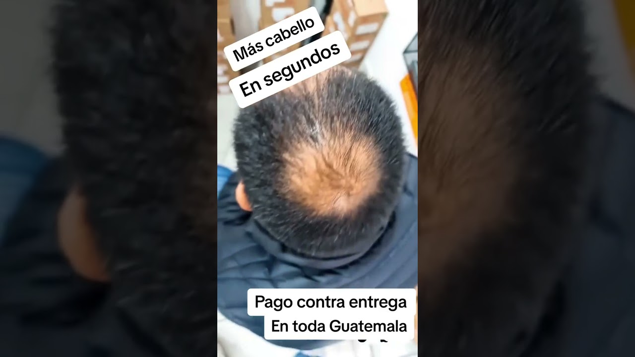 M&aacute;s cabello en segundos 🙌🏻 Fibras capilares Toppik con pago contra entrega en TODA 🇬🇹 #Guatemala