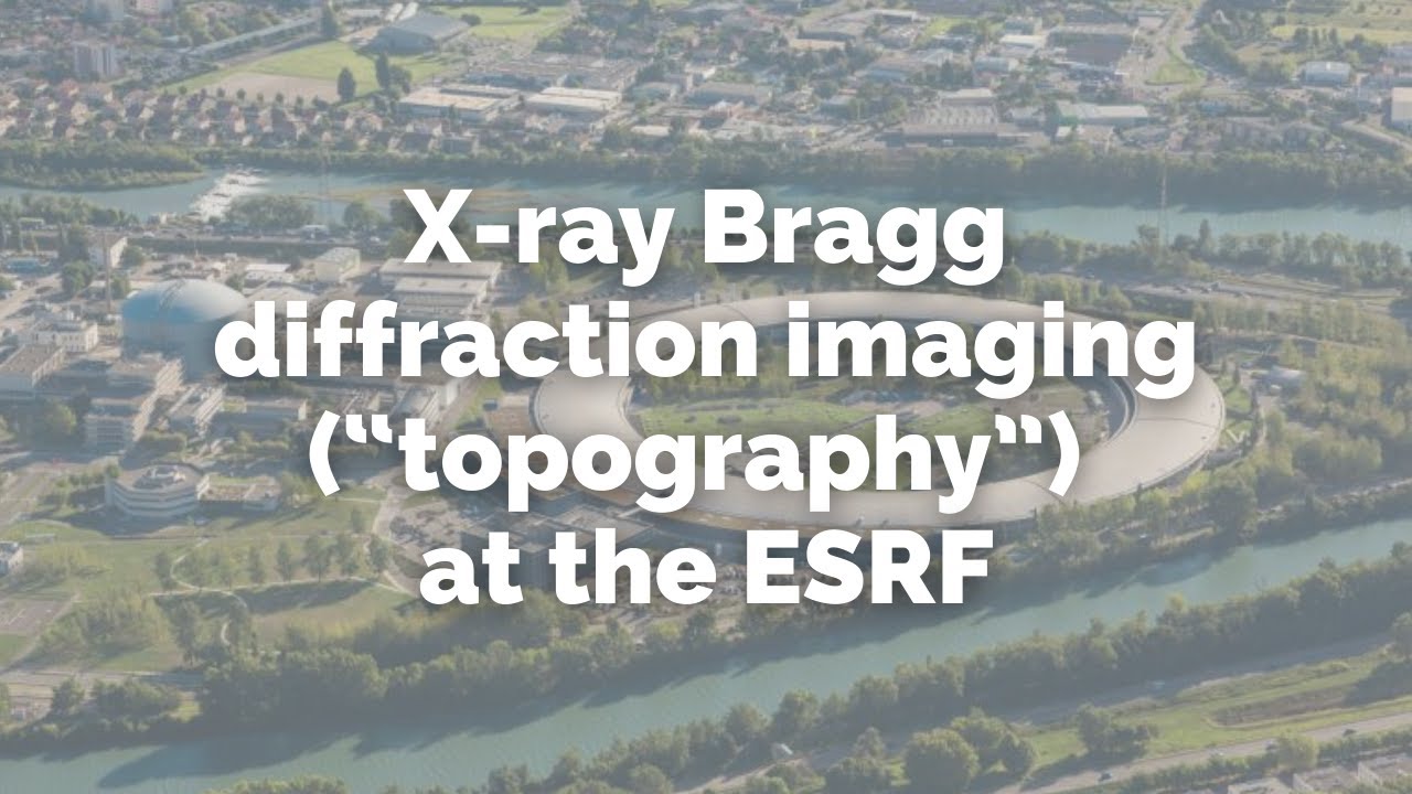 X-ray Bragg diffraction imaging (&ldquo;topography&rdquo;) at the ESRF