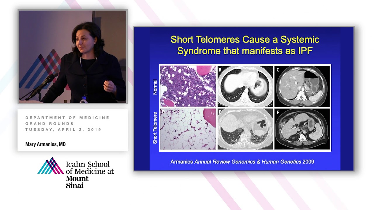 The Telomere Syndromes: A Paradigm for Molecular Medicine