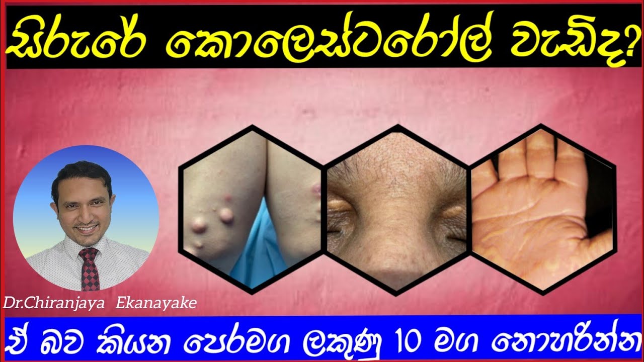 කොලෙස්ටරෝල් ඇවිත්ද කියා කලින්ම දැනගන්න - මේ ලක්ෂණ 10 තියේද බලන්න |Dr.Chiranjaya | @HealthySkinlk
