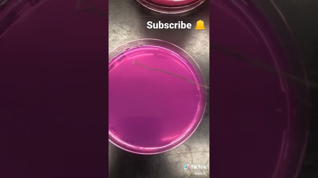 Isolation of fungus colony ❤️ Basic microbiology