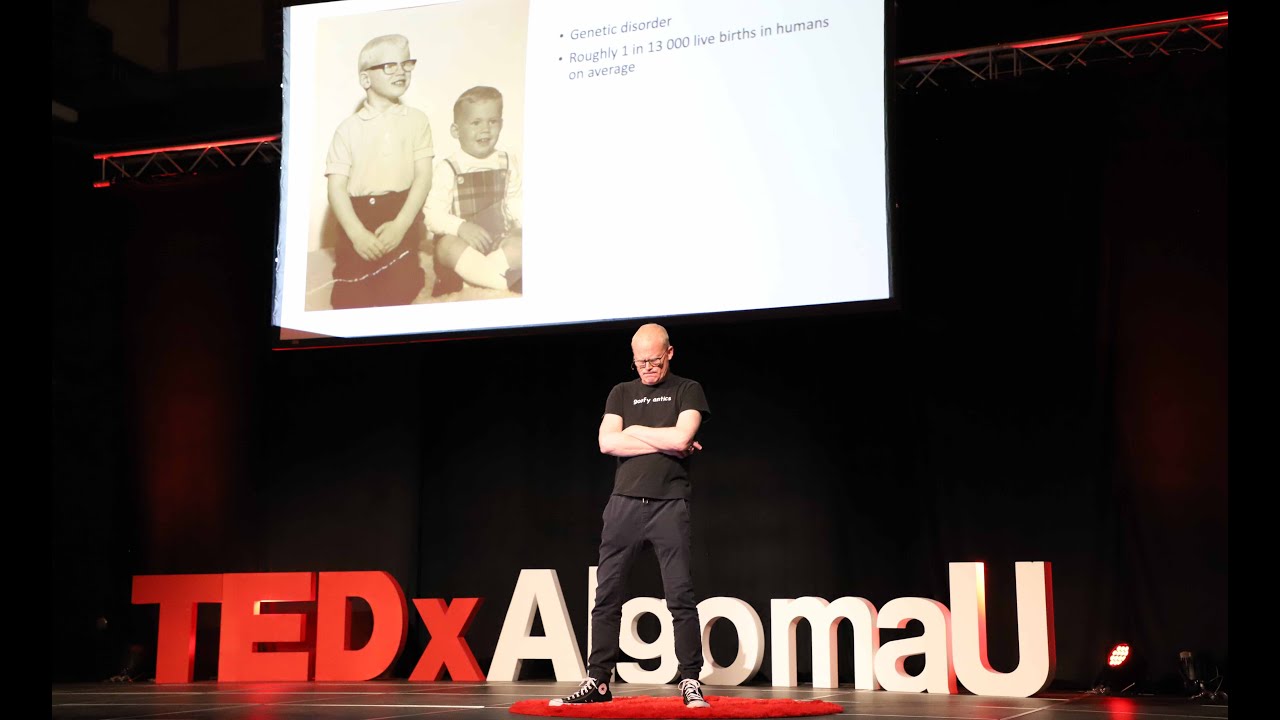 TEDx AlgomaU- Free your Genius: Dave Brodbeck