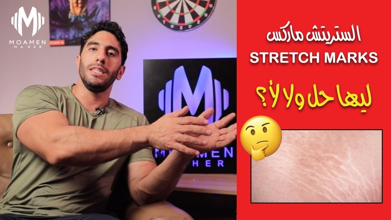 الحل النهائي لعلامات تمدد الجلد | Stretch marks
