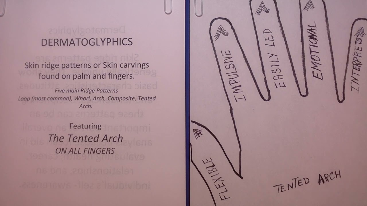 203 THE TENTED ARCH ON ALL FINGERS??!!
