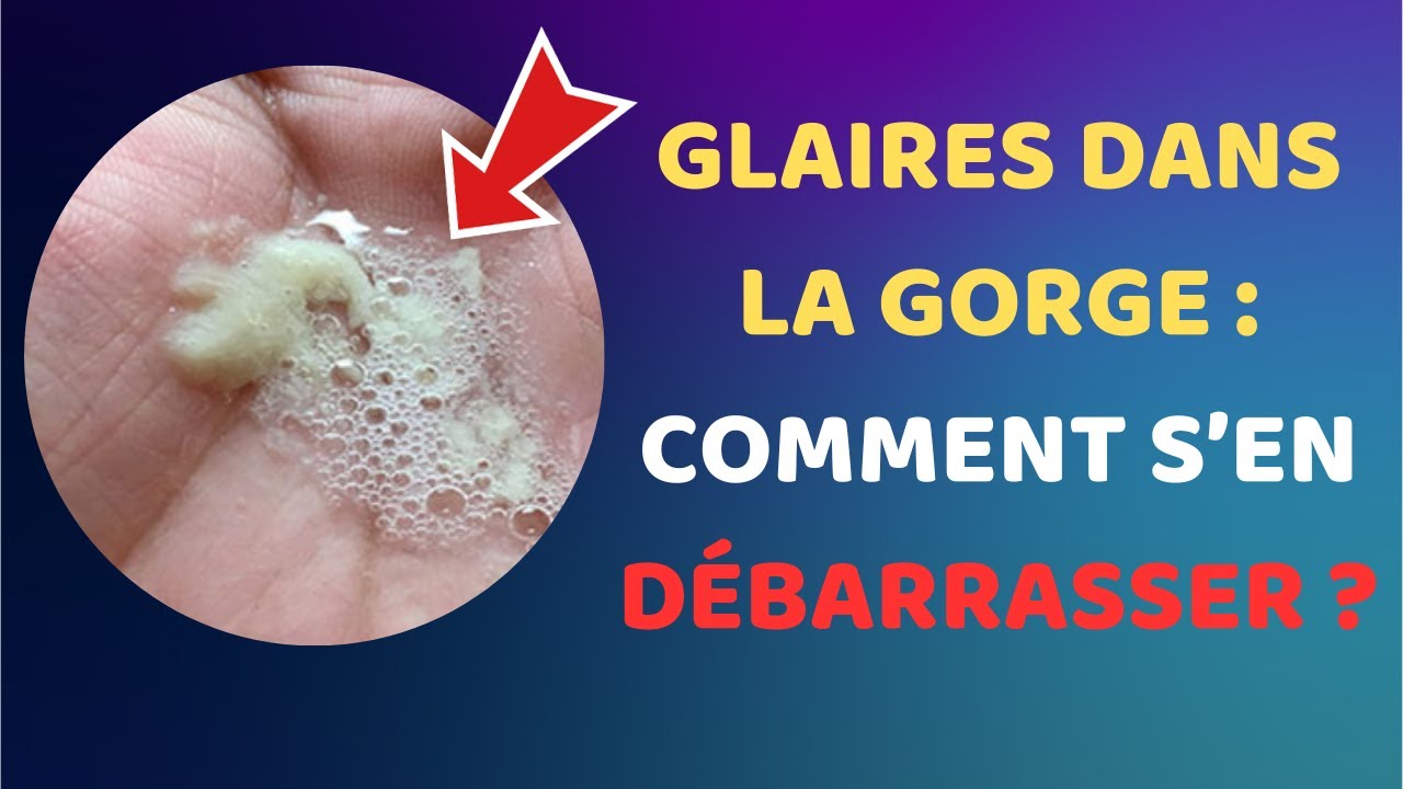 Comment se débarrasser des glaires dans la gorge ? Les remèdes naturels et efficaces