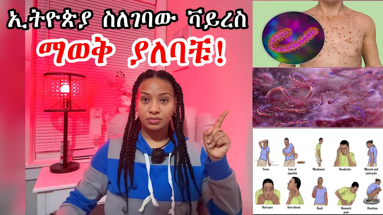 🛑አስደንጋጭ ዜና በኢትዮጵያ‼️ይሄን መልእክት አዳምጡ የበሽታው ምልክት እና ምን ማድረግና አለማድረግ እንዳለባቹ አውቃቹ ቆዩ በፀሎት በርቱ እግዚአብሄር አለ‼️