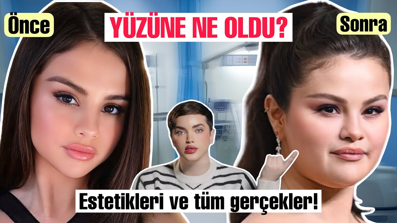 Selena Gomez'in Büyük Değişimi: Estetik mi, Hastalık mı?