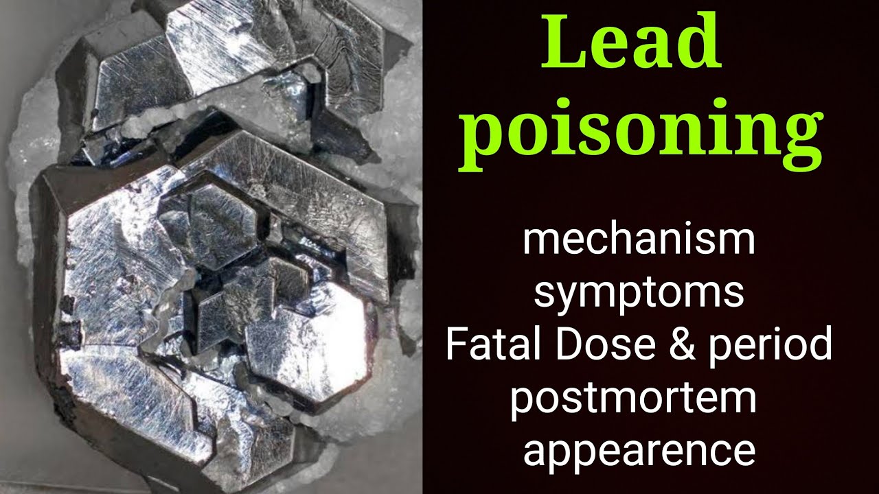 Lead poisoning | Heavy metal poisoning | Toxicology