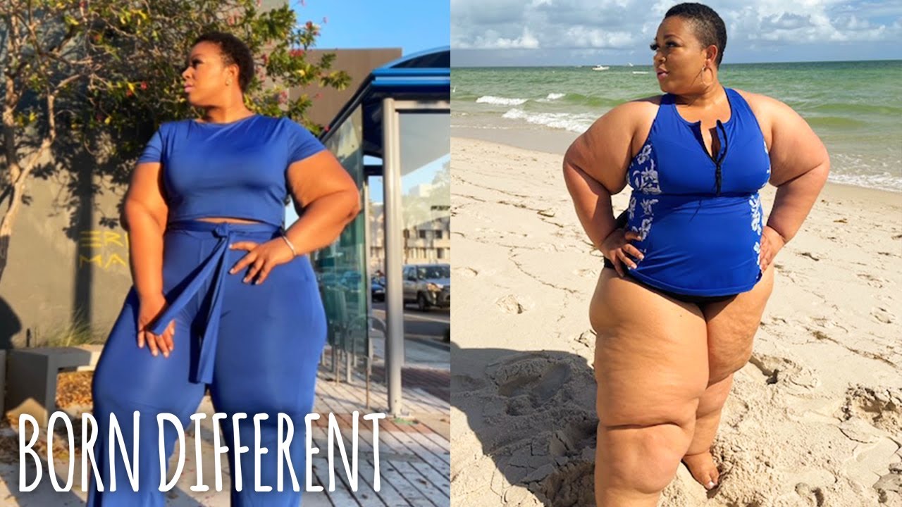 I Spent Years Hiding My Lymphedema Legs - Not Anymore | BORN DIFFERENT