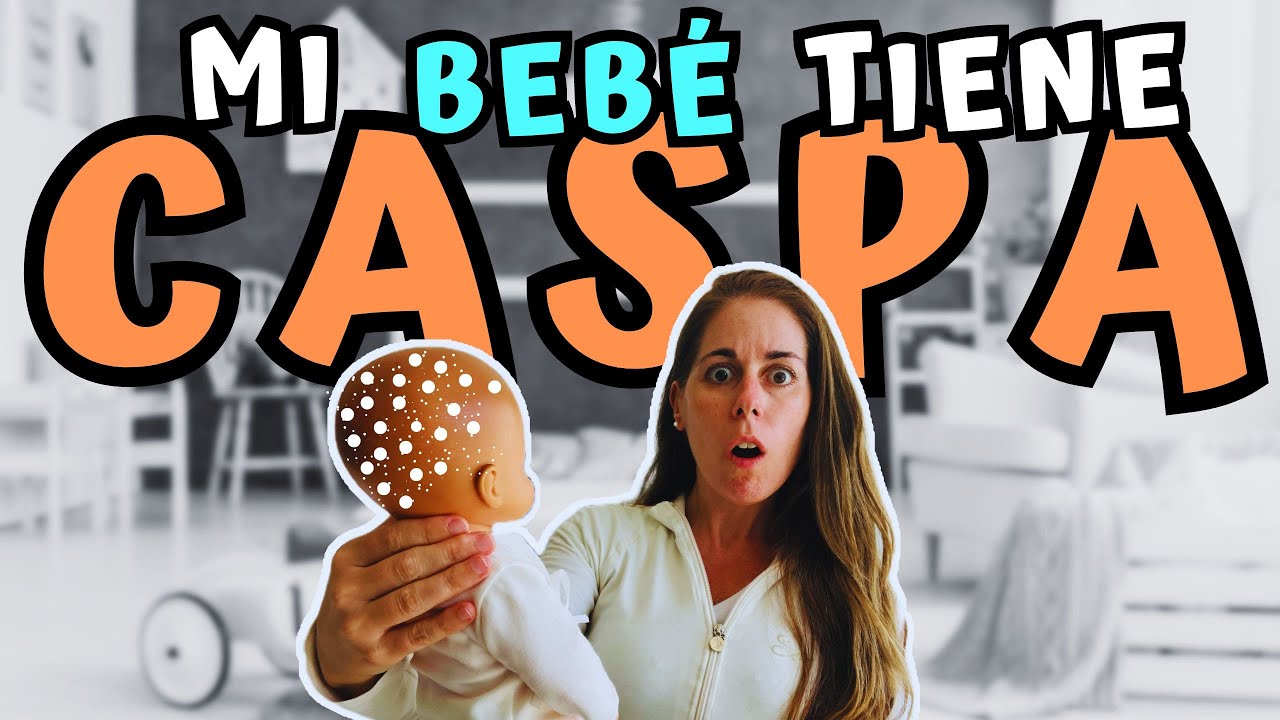 Cómo quitar la CASPA o COSTRA LÁCTEA a mi bebé recién nacido