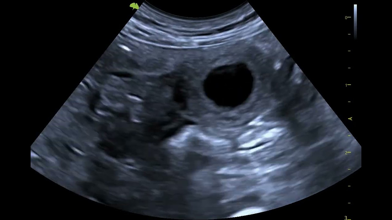 Chihuahua Early Pregnancy Scan