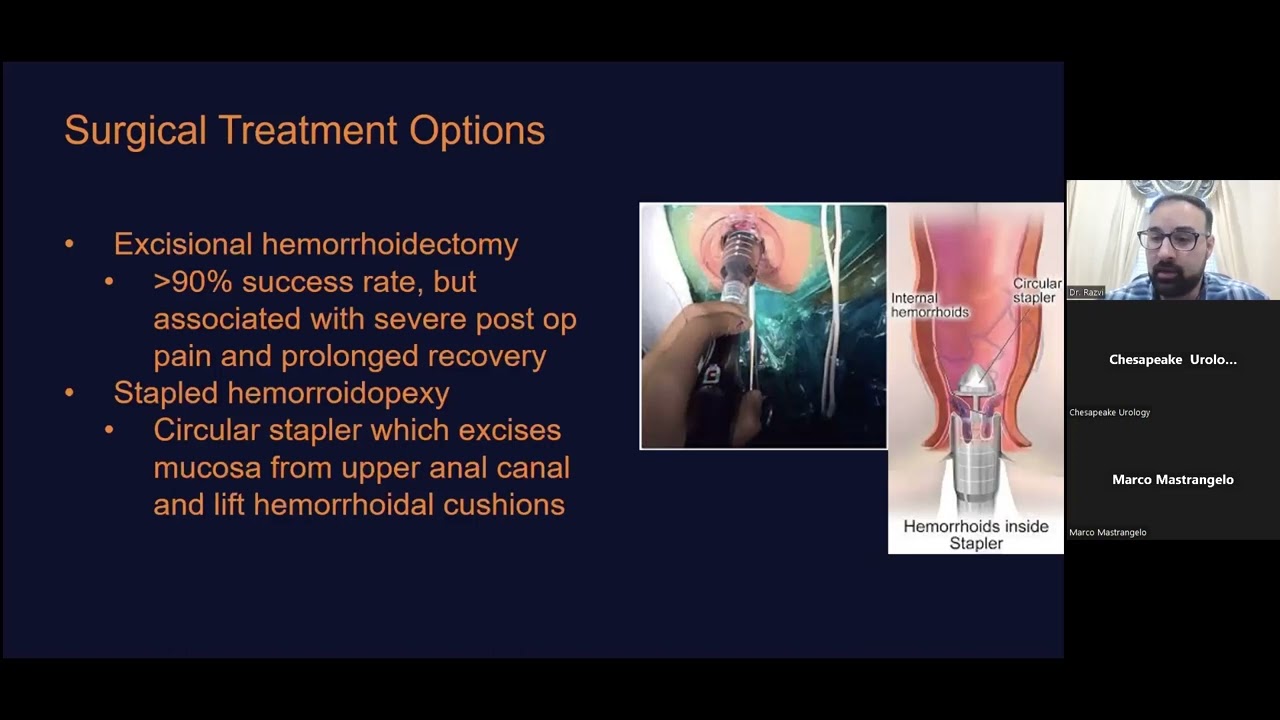 Learn about the treatments available at the IR Centers at Chesapeake Urology