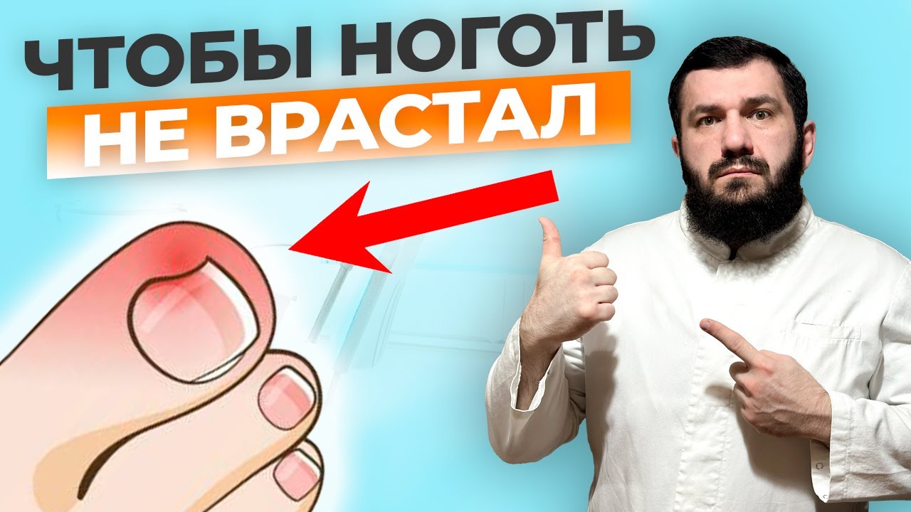 Вросший ноготь: вылечить быстро и навсегда!