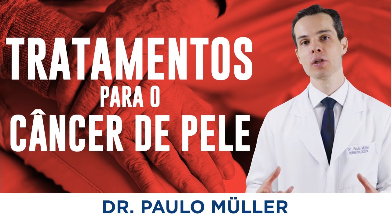 Como tratar o Câncer de Pele - Tipos de tratamentos - Dr. Paulo Müller Dermatologista-