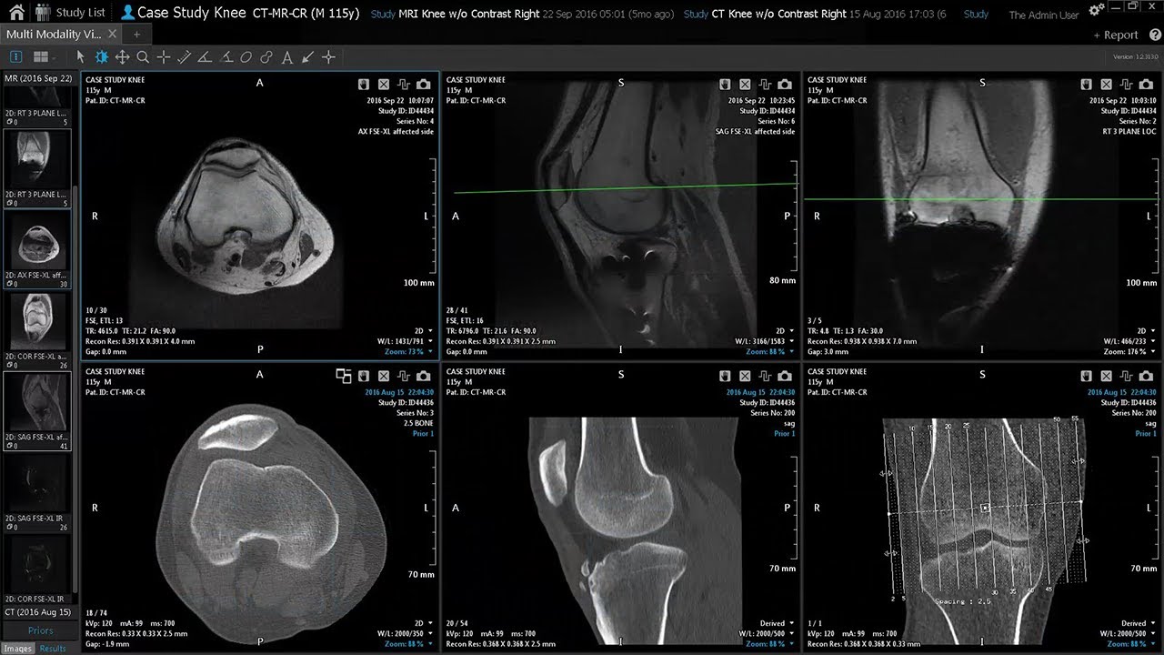 Vitrea Applications Overview | Multi Modality Viewer