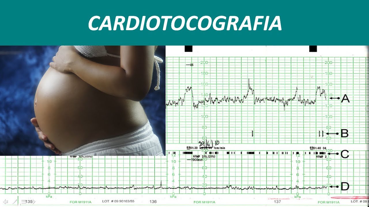 Cardiotocografia