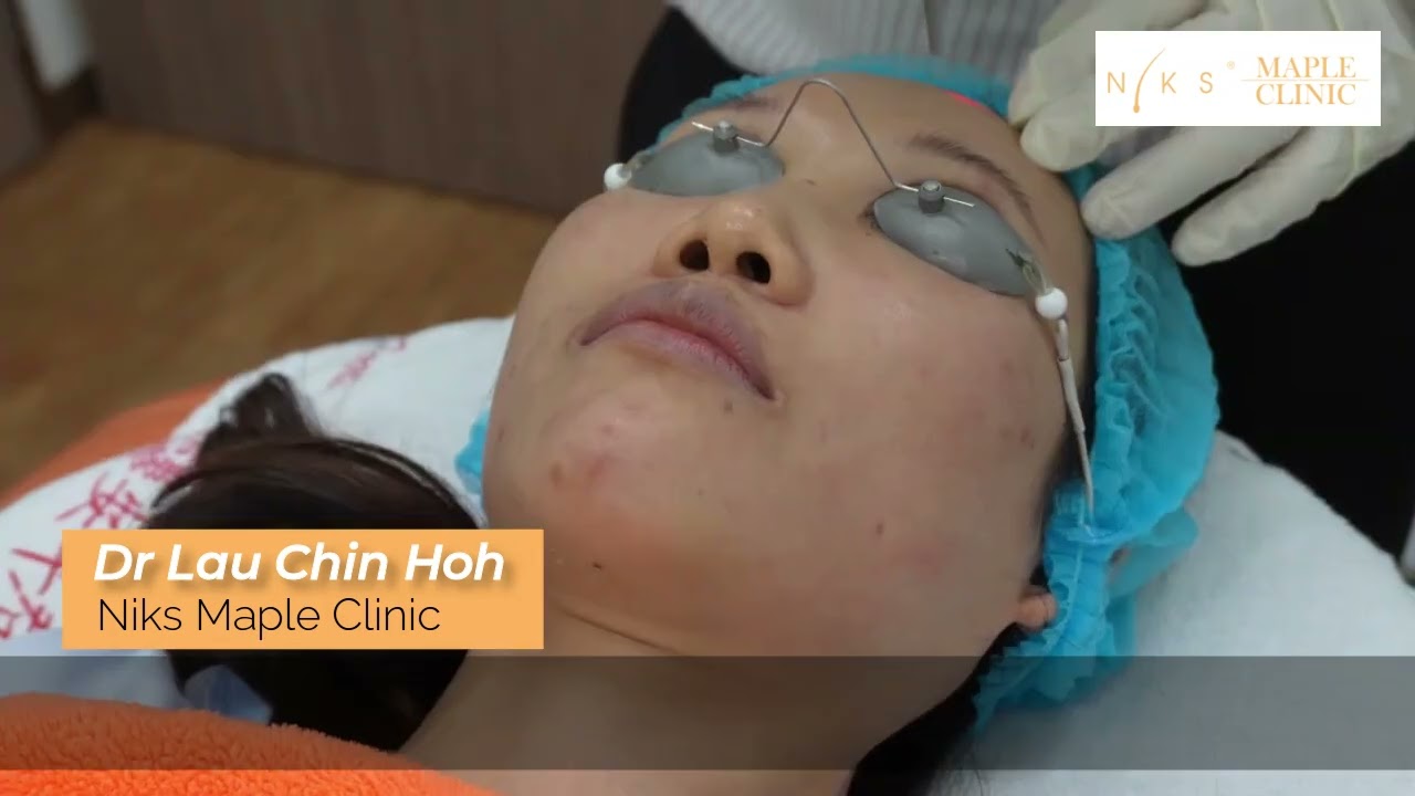 Dr Lau Chin Hoh on PicoSure. #picolaser #picosure #laserclinic #pigmentation #tattooremoval