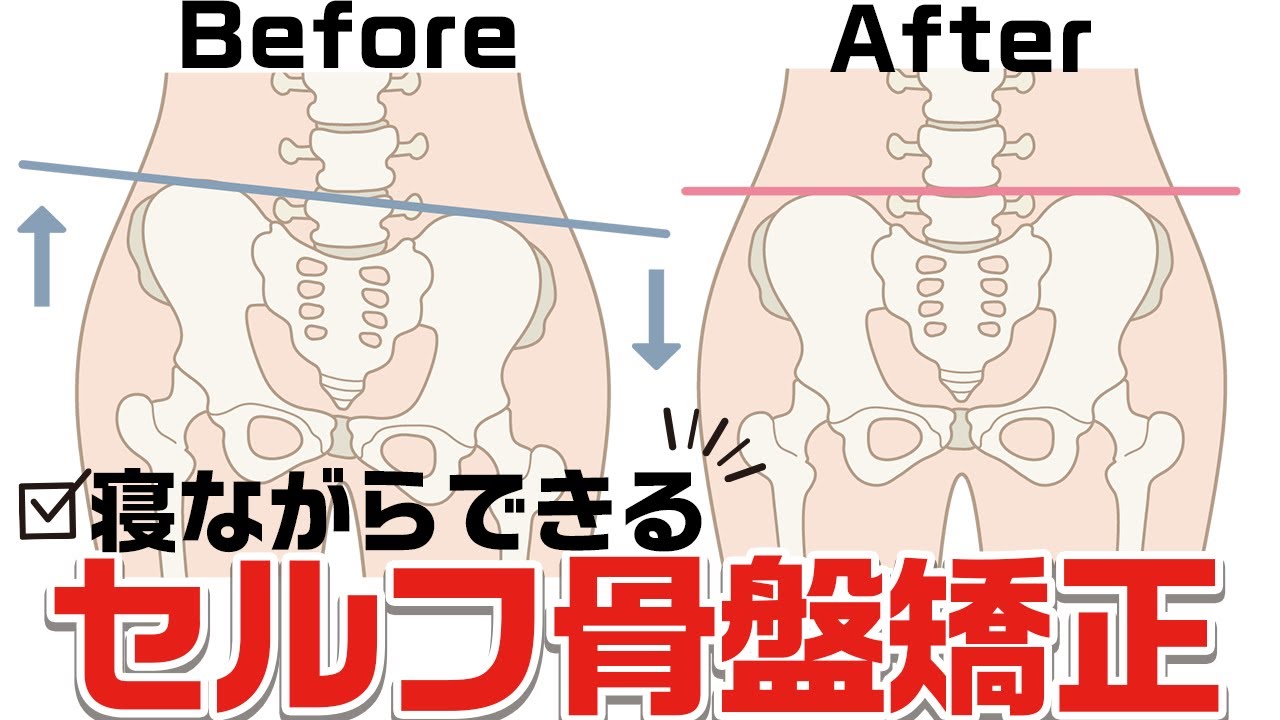 【骨盤のズレ＆ゆがみ、腰痛でお悩みの方、必見】骨盤のズレセルフチェックから改善方法まで全て公開。側弯症、冷え、脚のむくみ、腰痛を改善する「セルフ骨盤矯正方法」【大分県大分市 綜合整体 GENRYU 】
