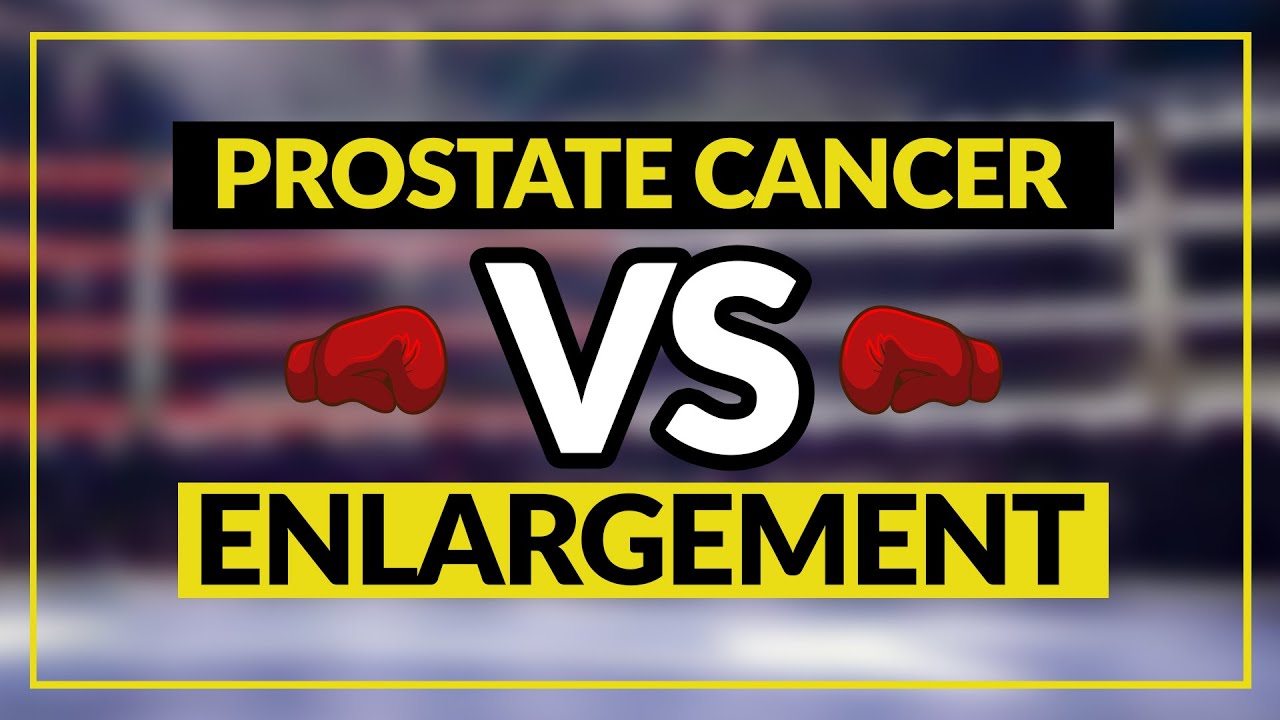 Prostate Cancer vs Just Enlargement? | Fairbanks Urology | Dr Tony Nimeh Urologist
