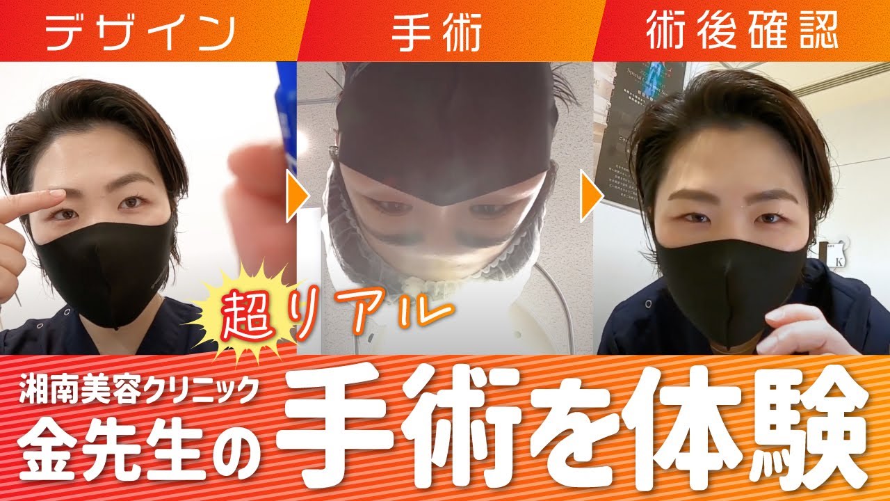 【二重手術の1日】が分かる！デザインってどうやる？手術の流れって？クイックコスメティークダブル・トリプルをするなら必見！【埋没法】