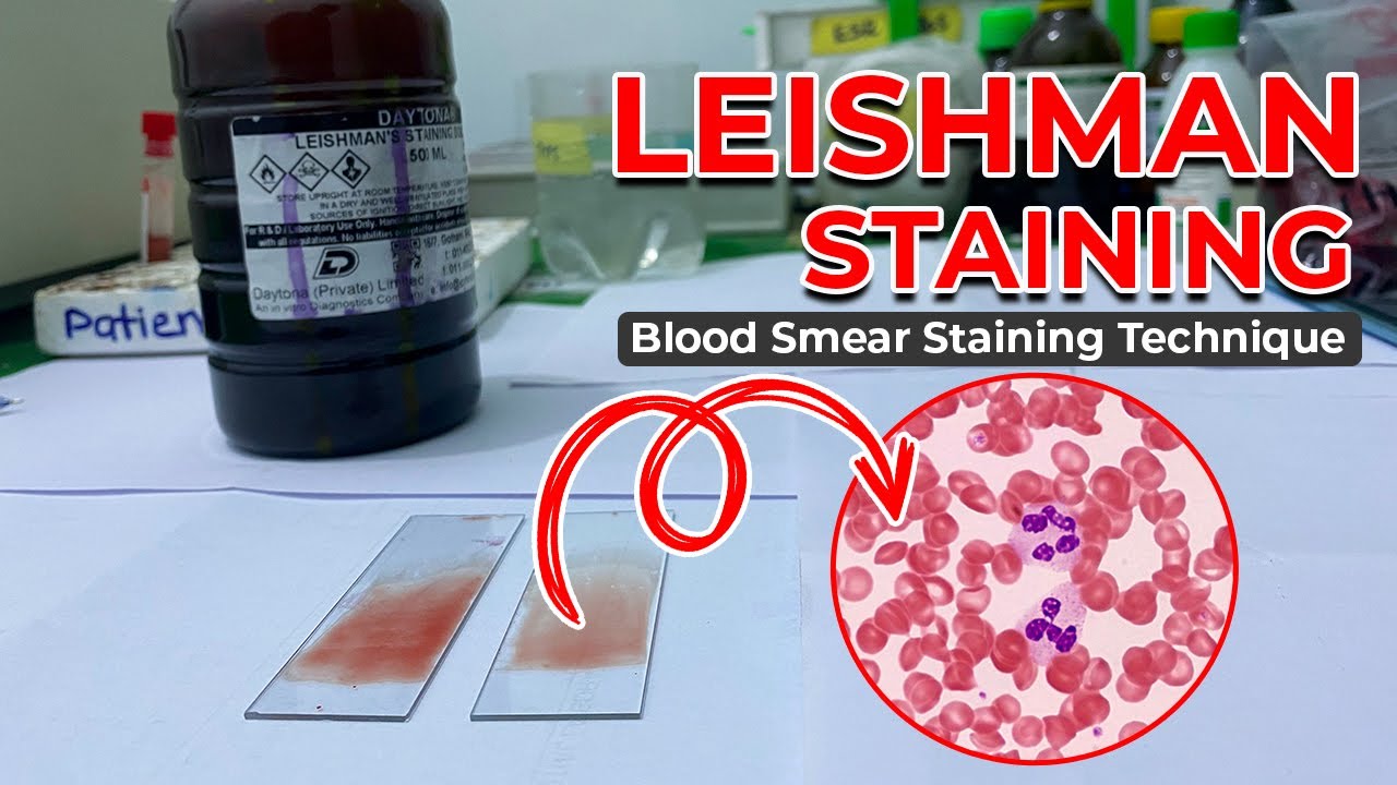 LEISHMAN STAINING | Blood Smear Staining Technique | Heamatology