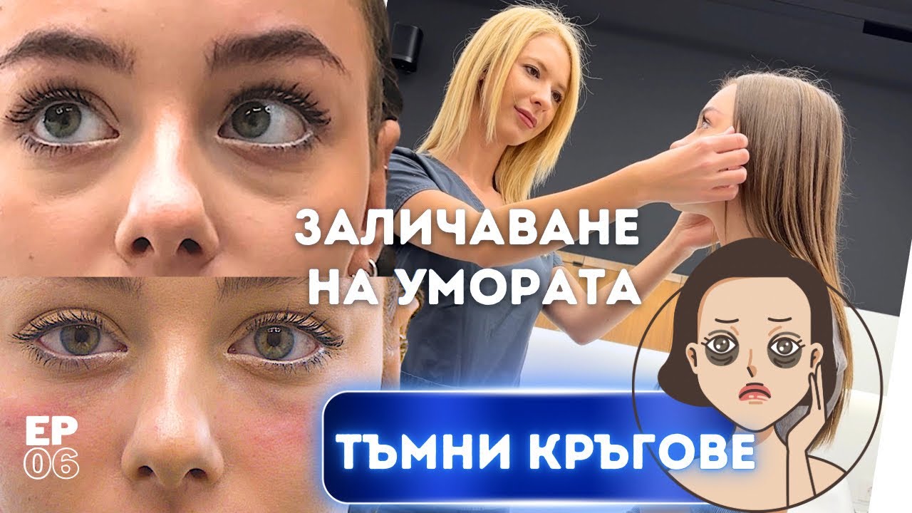 Заличаване на ТЪМНИ КРЪГОВЕ! 🥱😴 СВЕЖИ, дори когато НЕ сме се НАСПАЛИ! 🤩