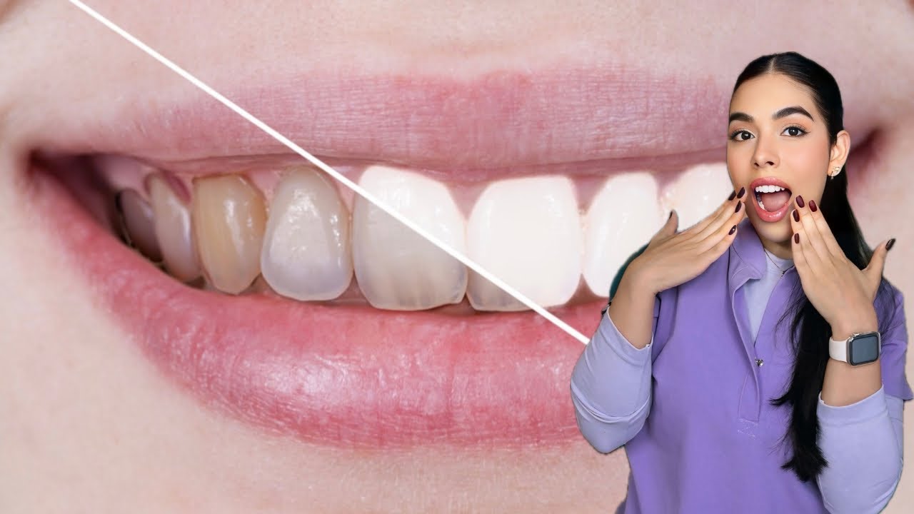 COMO TENER DIENTES BLANCOS| DRA DANI FERMIN