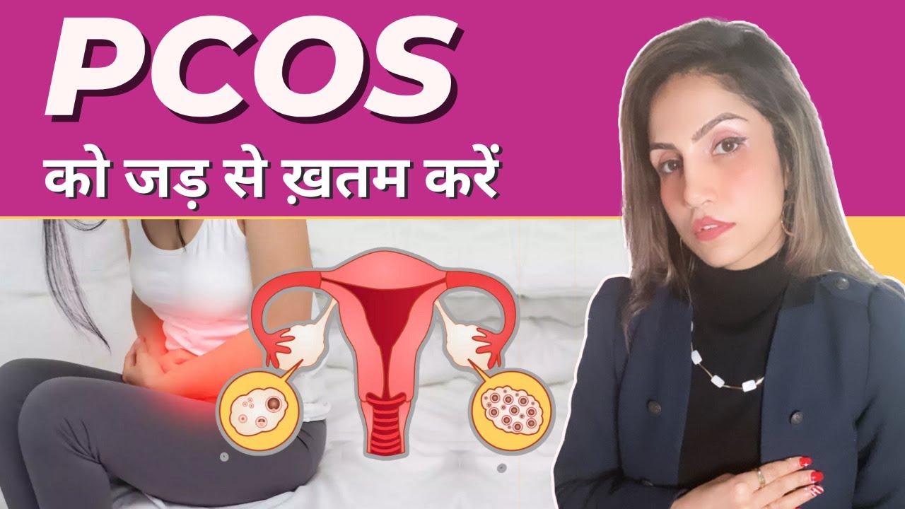 Reverse PCOS with Diet & Lifestyle | PCOS को सिर्फ 6 महीने में जड़ से ख़तम करें | PCOS Treatment