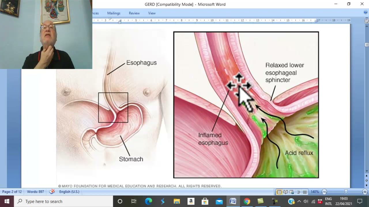 Esophageal disorders in Arabic 5 ( Gastro-esophageal reflux disease , part 2) , by Dr. Wahdan.