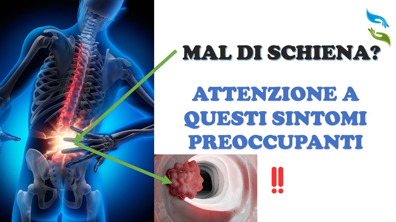 Mal di schiena? ATTENZIONE a questi sintomi!