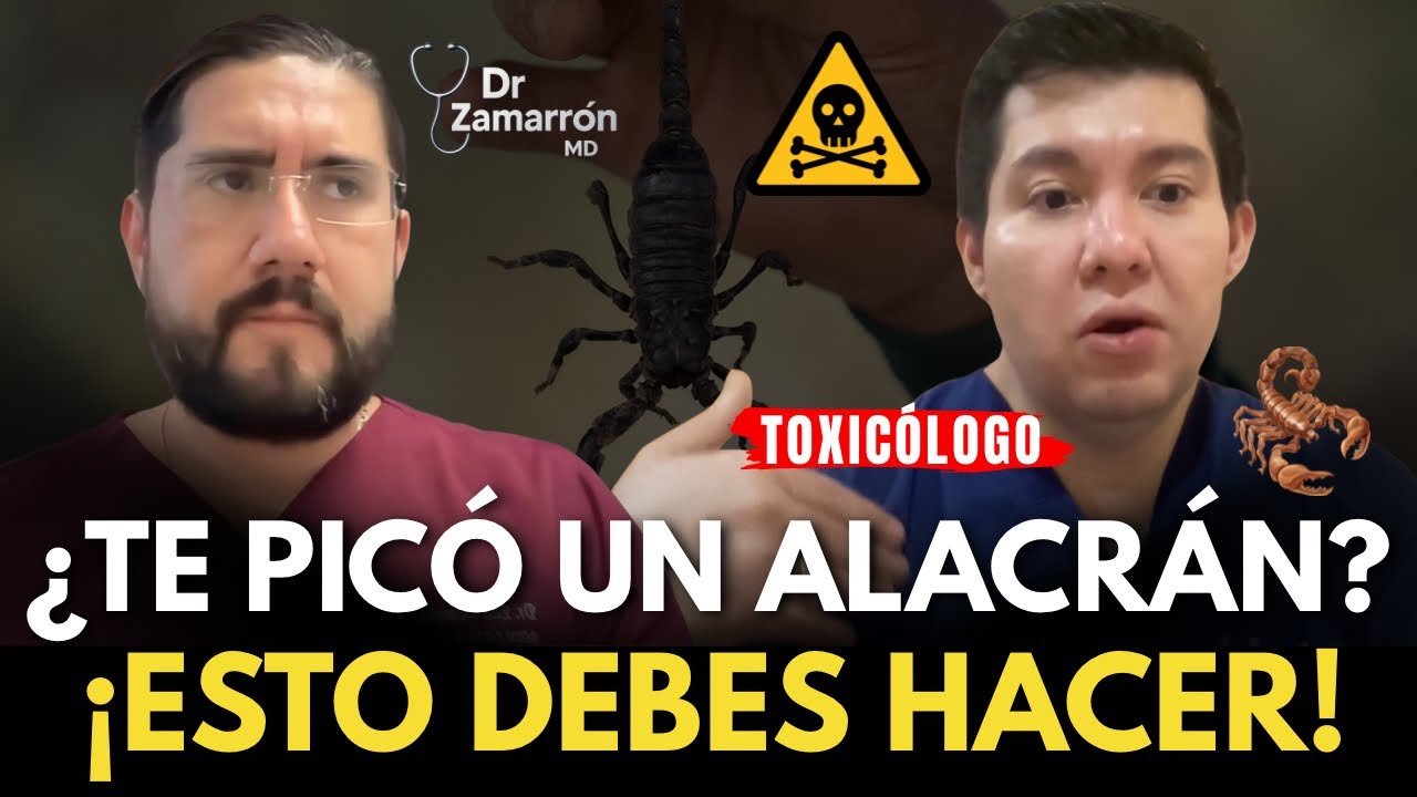 🦂 ¿Qué hacer si te pica un ALACRÁN? | Médico Toxicólogo lo explica
