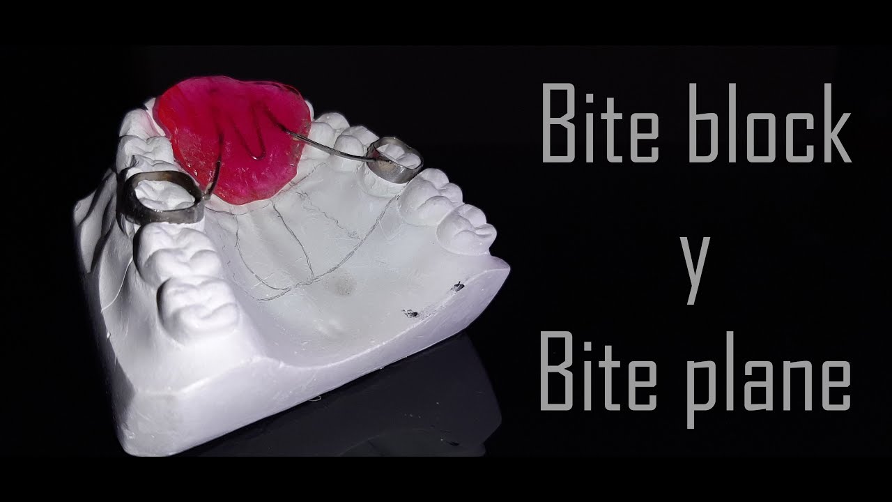 Elaboración de Bite Plane y Bite Block | Elena Dental Art & More