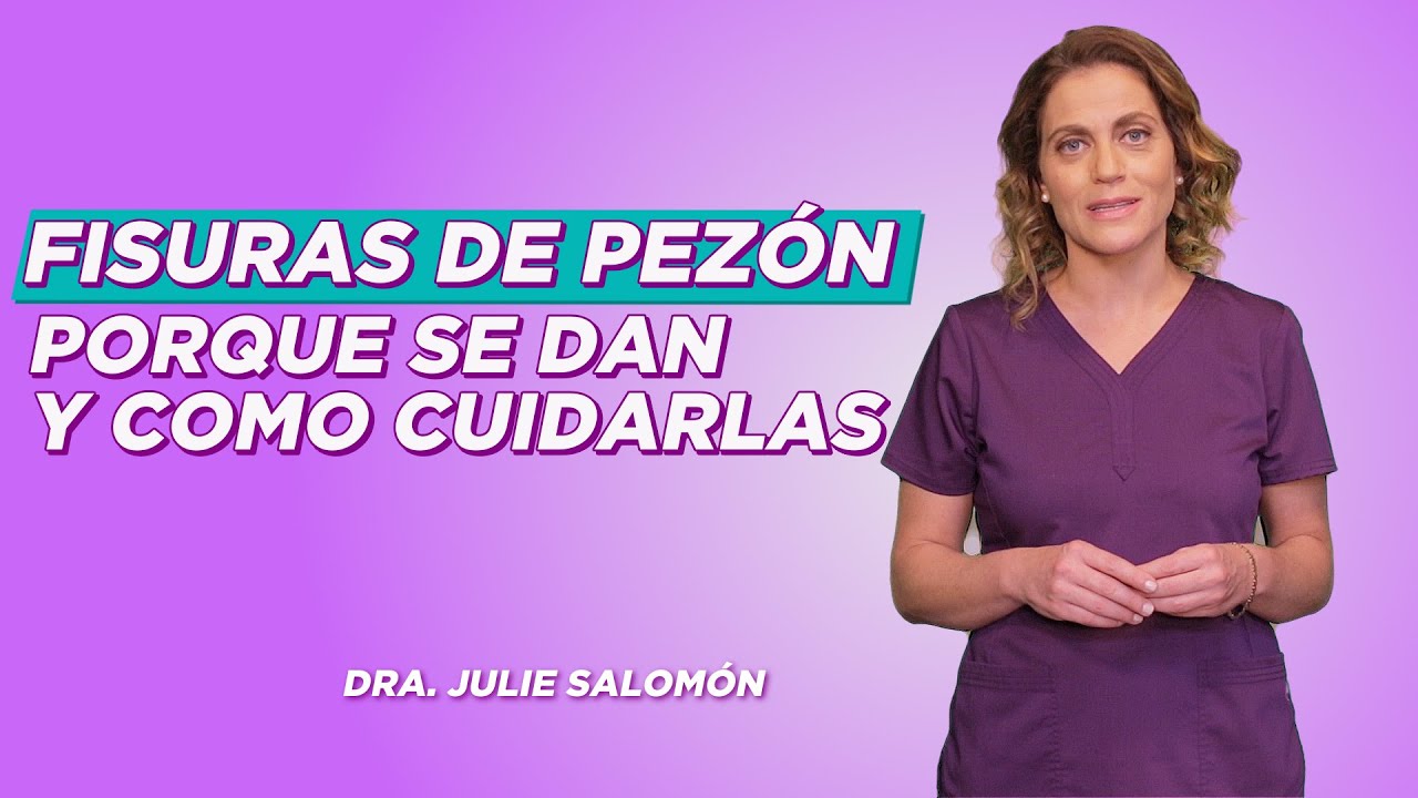 Fisuras de pez&oacute;n, porque se dan y como cuidarlas | Salud180