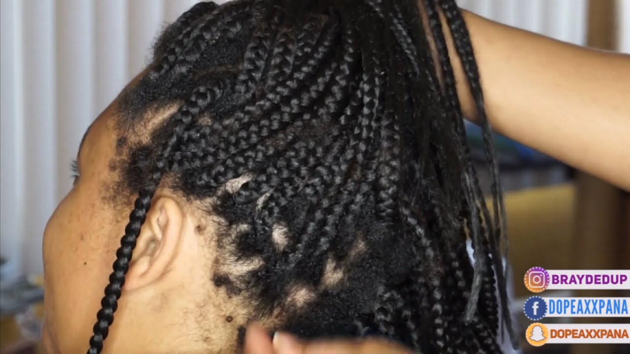 OMG!!! 2 1/2 Month Old Box Braid Take Down| So Much BREAKAGE?! | Hair Growth Transformation #2