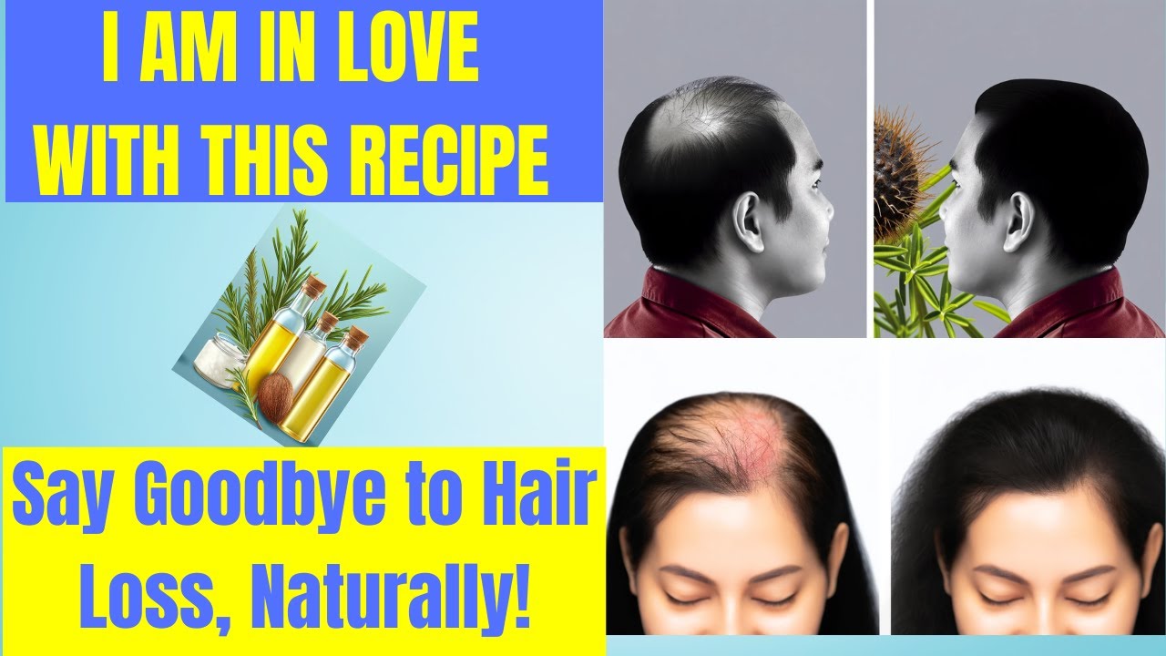 How to Stop Hair Loss and Promote Hair Growth Naturally| Castor Oil, Coconut Oil & Rosemary Oil Reci