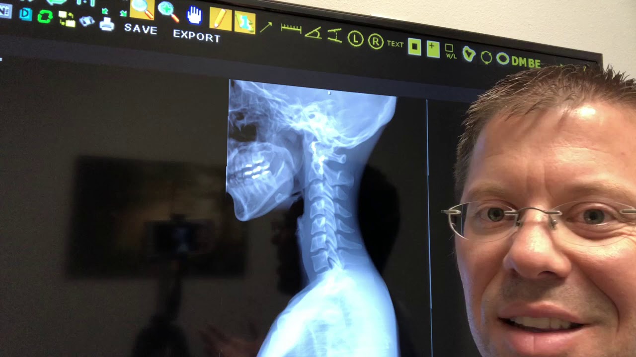 Kyle Chiropractor Tips To Help You After a Car Accident