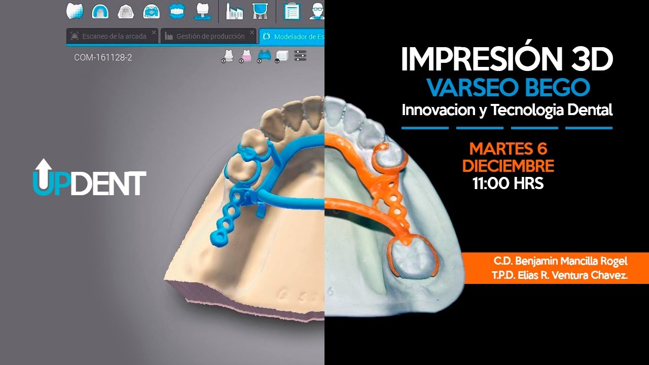 Impresión 3D Varseo BEGO. Innovacion y Tecnologia Dental