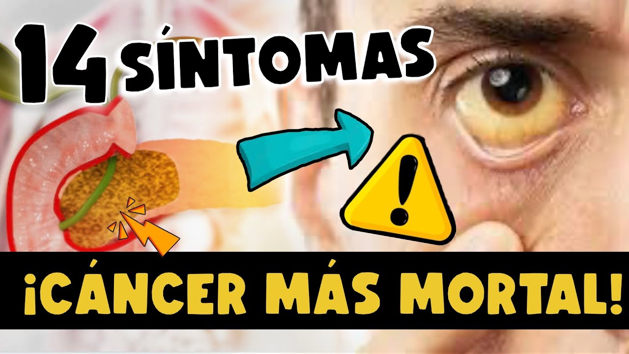 ¡CUIDADO! CÁNCER DE PÁNCREAS EL MÁS MORTAL - 14 SÍNTOMAS A TOMAR EN CUENTA