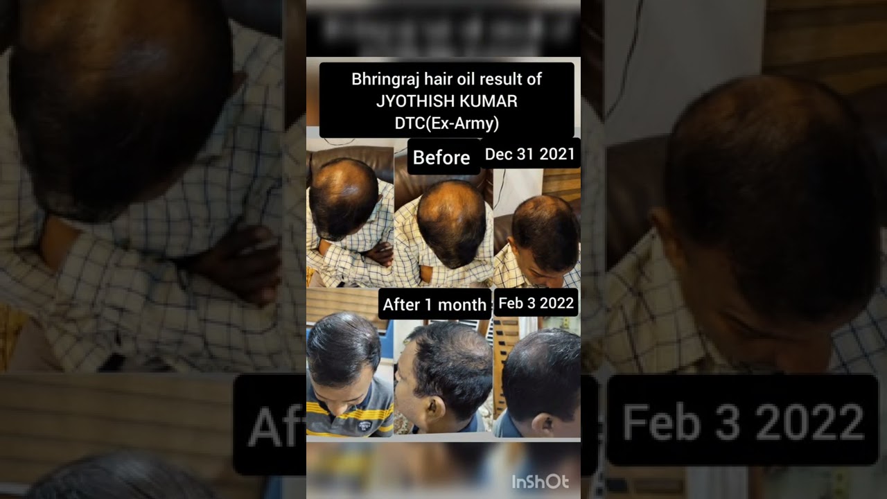 elements wellness product real result |malayalam |mi life style products