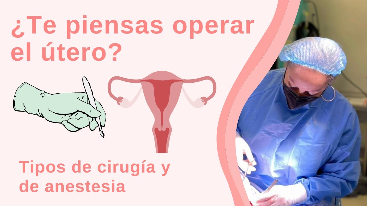 Preguntas frecuentes sobre la histerectomía (operar y quitar el útero)