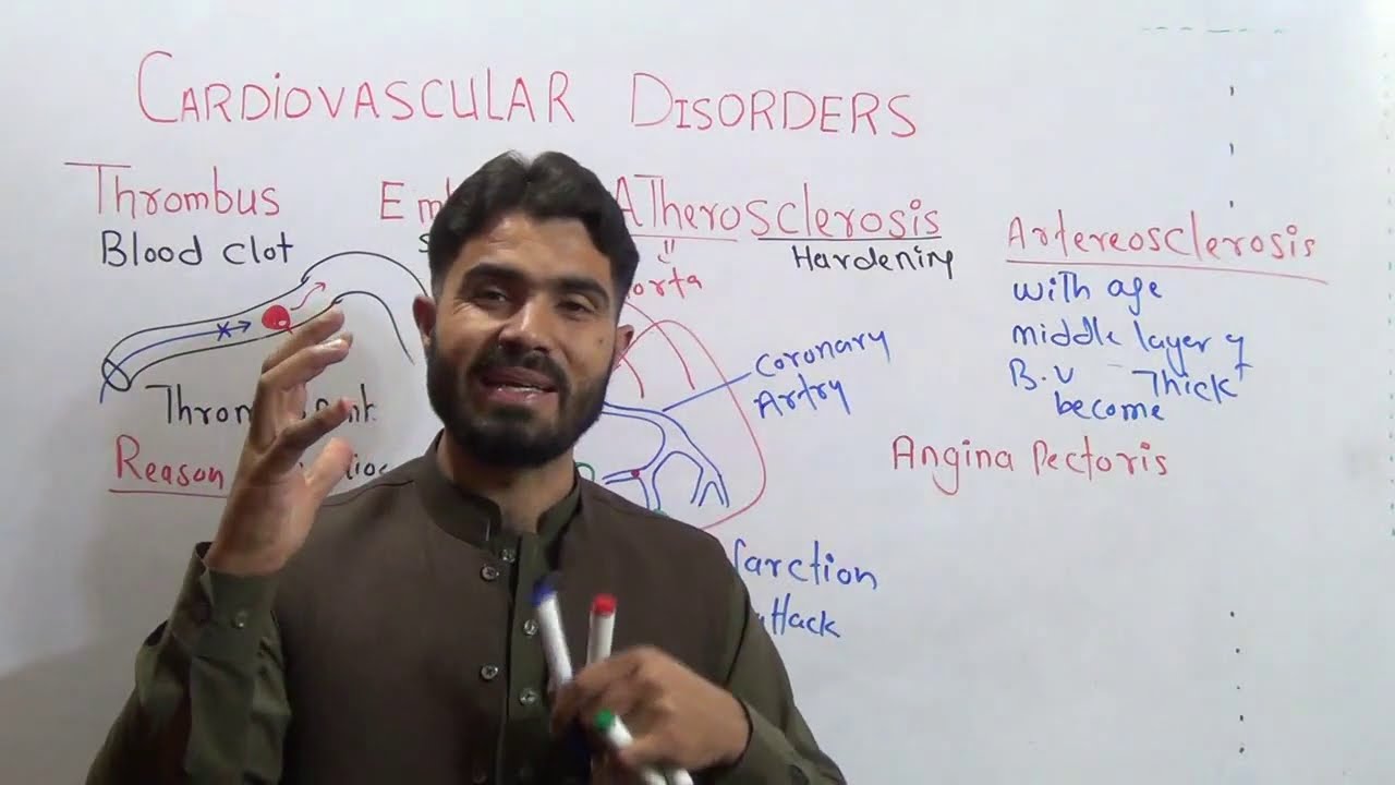 Cardio Vascular Disorders Thrombus, Embolus Atherosclerosis Heart Attack Angina Pectoris and Stroke