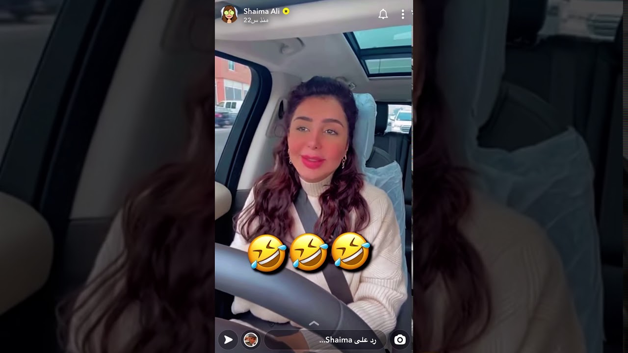 قصة شيماء علي مع أول عملية شفايف