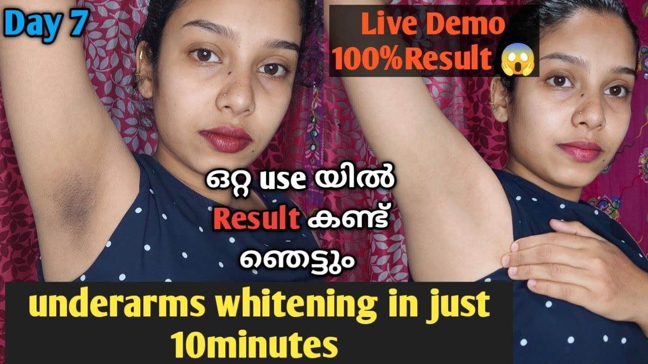 Live Result കണ്ട് ഞെട്ടാൻ ready ആണോ 😱Underarms whitening at home in just 10 minutes//live demo
