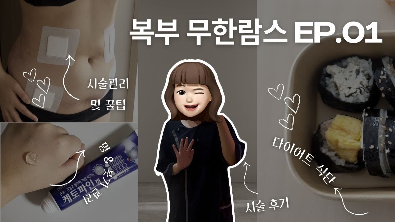 복부무한람스 ep.01ㅣ시술 당일부터 일주일차 솔직 후기 (feat. 아랫배 삭제와 멍을 곁들인..)