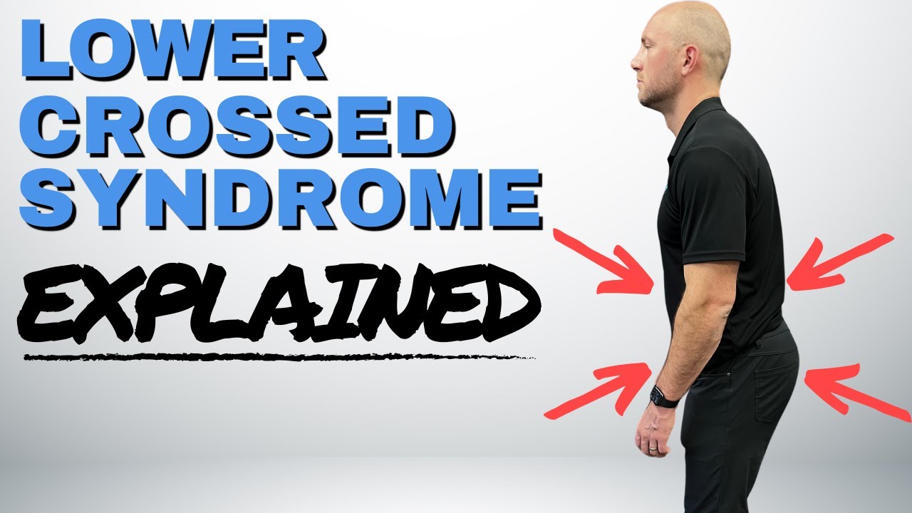 What is Lower Crossed Syndrome (LCS) and What Are the Symptoms?